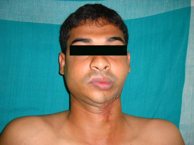 1st picture Pre operation